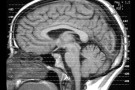 Menti geniali? Dipende dalla connettività Menti geniali? Dipende dalla connettività