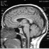 Menti geniali? Dipende dalla connettività